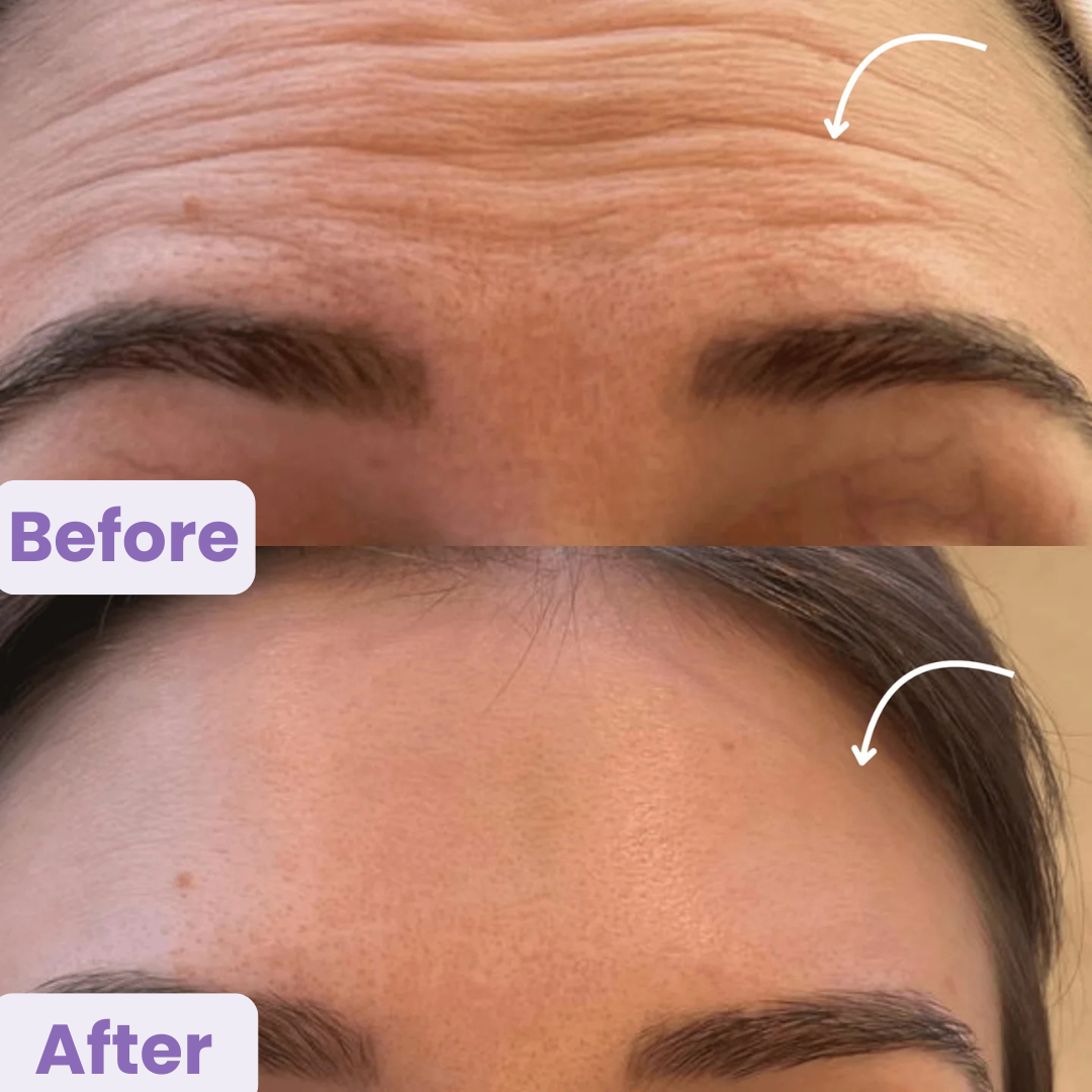 Lymphatic Drainage Facial Brush