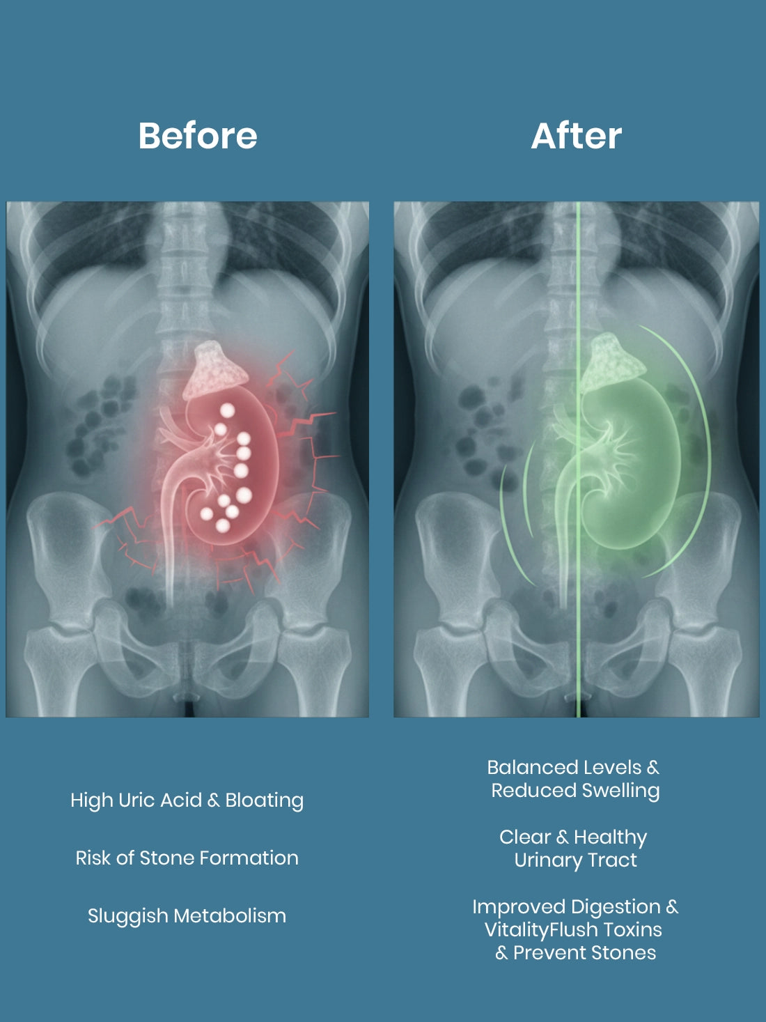 Kidney Care Juice