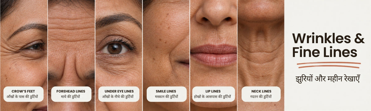 Wrinkles &amp; Fine lines