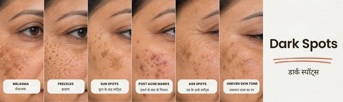 Dark Spots