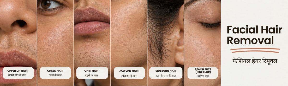 Facial Hair Removal