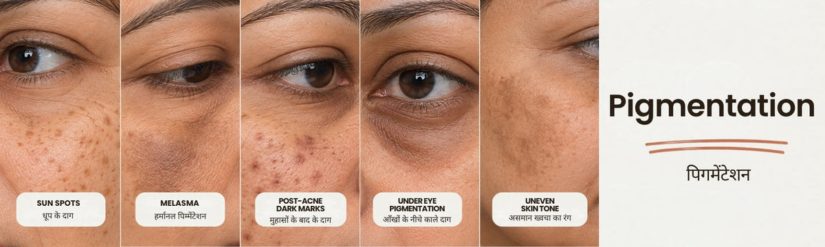 Pigmentation