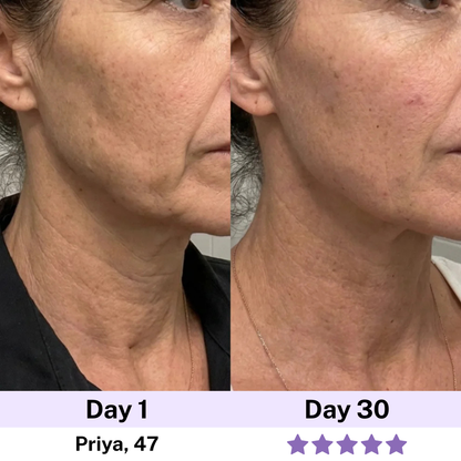7-in-1 LED Facial Sculptor
