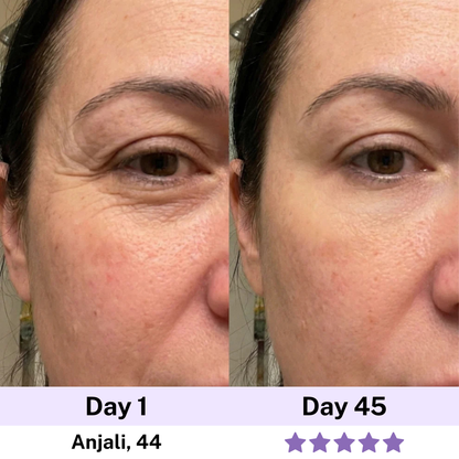 7-in-1 LED Facial Sculptor