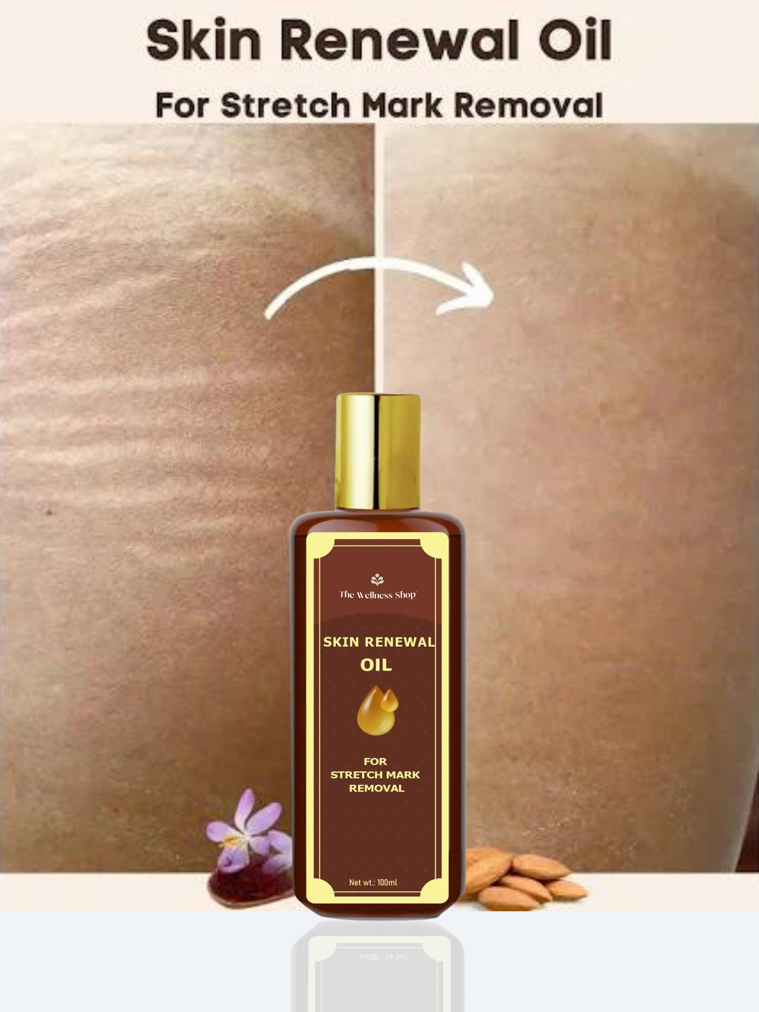 SKIN RENEWAL OIL - FOR STRETCH MARK REMOVAL (4 WEEKS CHALLENGE)