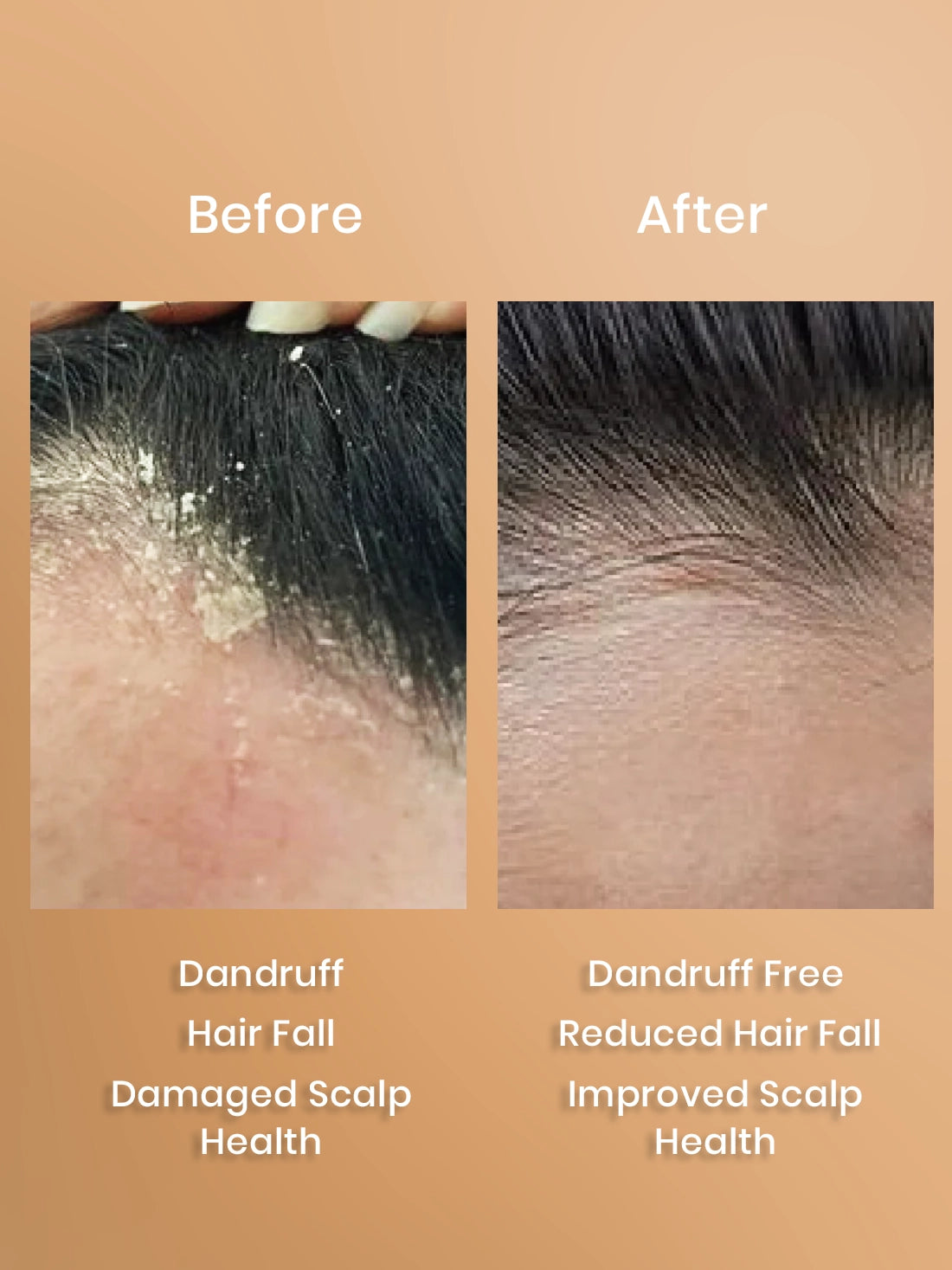 18 Herbs Hair Growth Oil