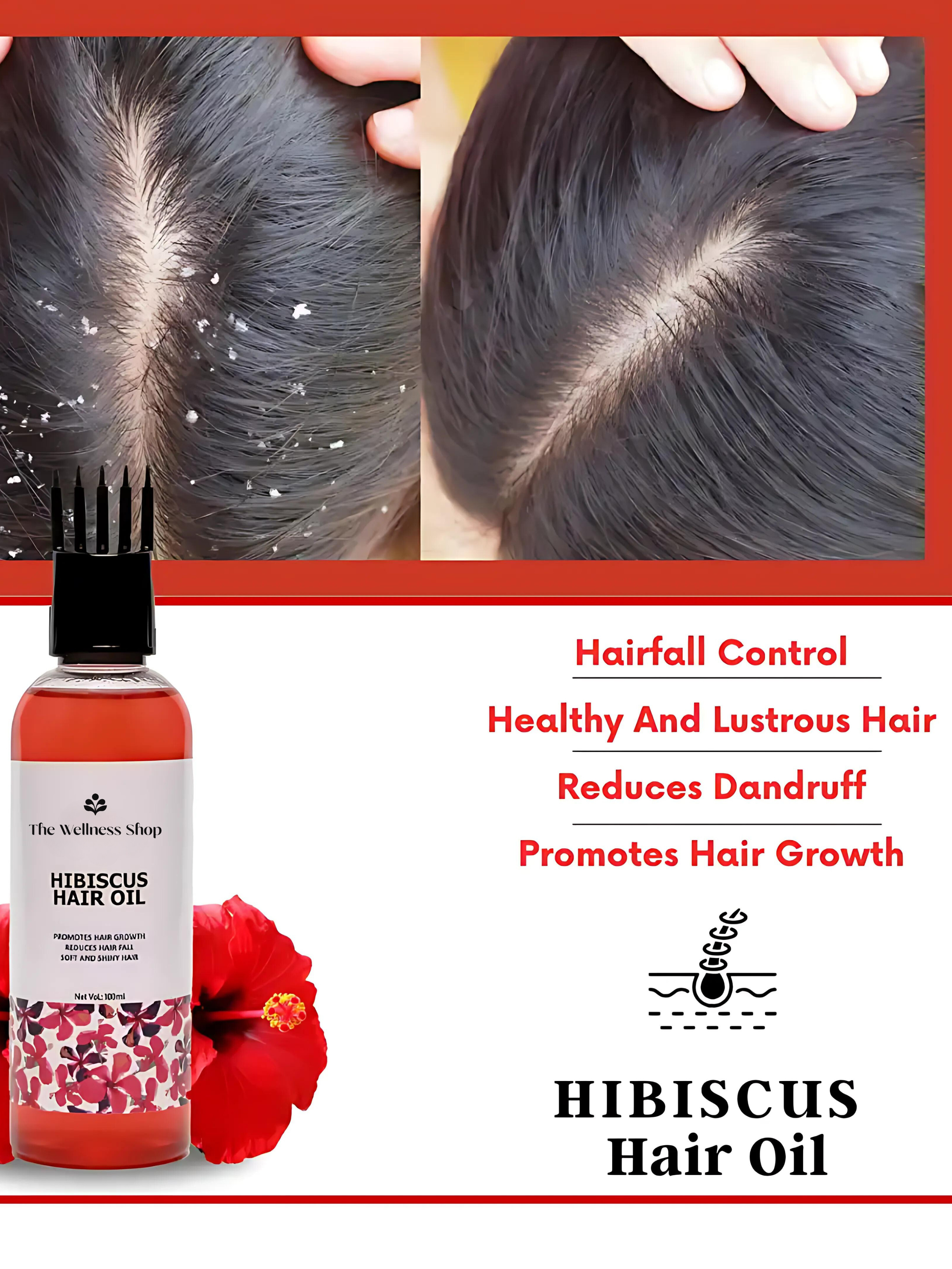 HIBISCUS HAIR OIL FOR HAIR FALL CONTROL AND REGROWTH (CONTROL HAIR FALL IN 4 WEEKS)