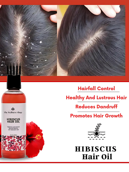 HIBISCUS HAIR OIL FOR HAIR FALL CONTROL AND REGROWTH (CONTROL HAIR FALL IN 4 WEEKS)