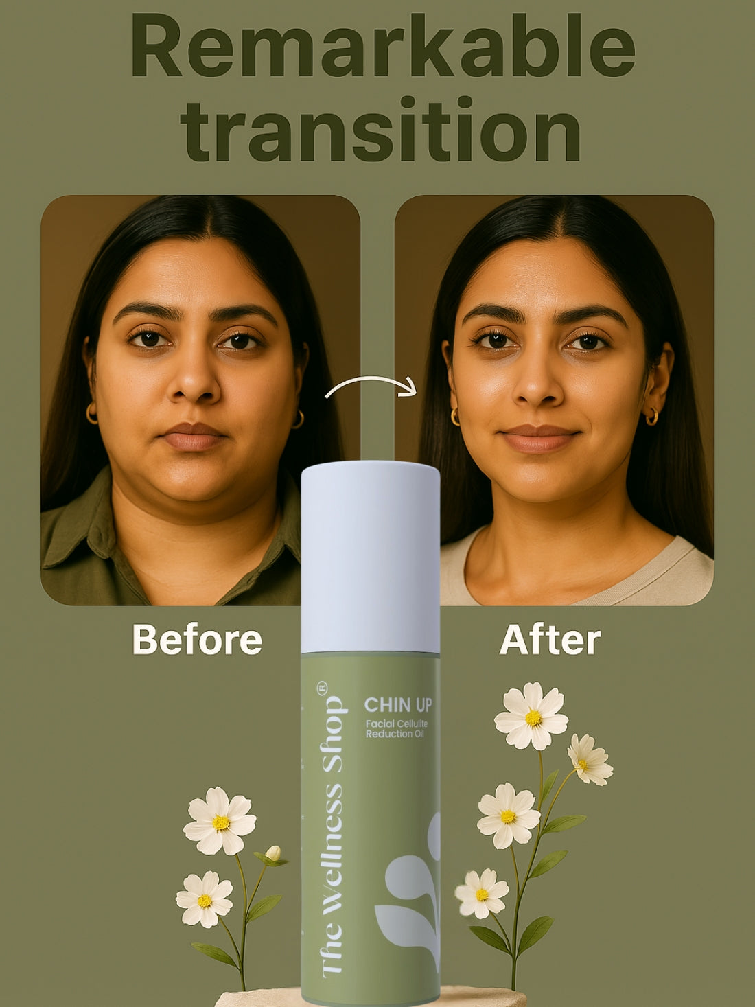 CHIN UP FACIAL CELLULITE REDUCTION KIT