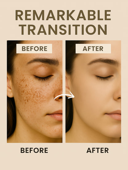 KOJIC ACID SERUM