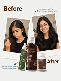 18 Herbs Complete Hair Regrowth