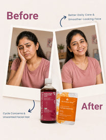 PCOS PCOD Reset Kit ( PCOS & PCOD Cycle Care Juice , Turmeric Facial Wax Powder)