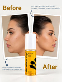 Chin Up Facial Cellulite Reduction ( 4 Weeks )