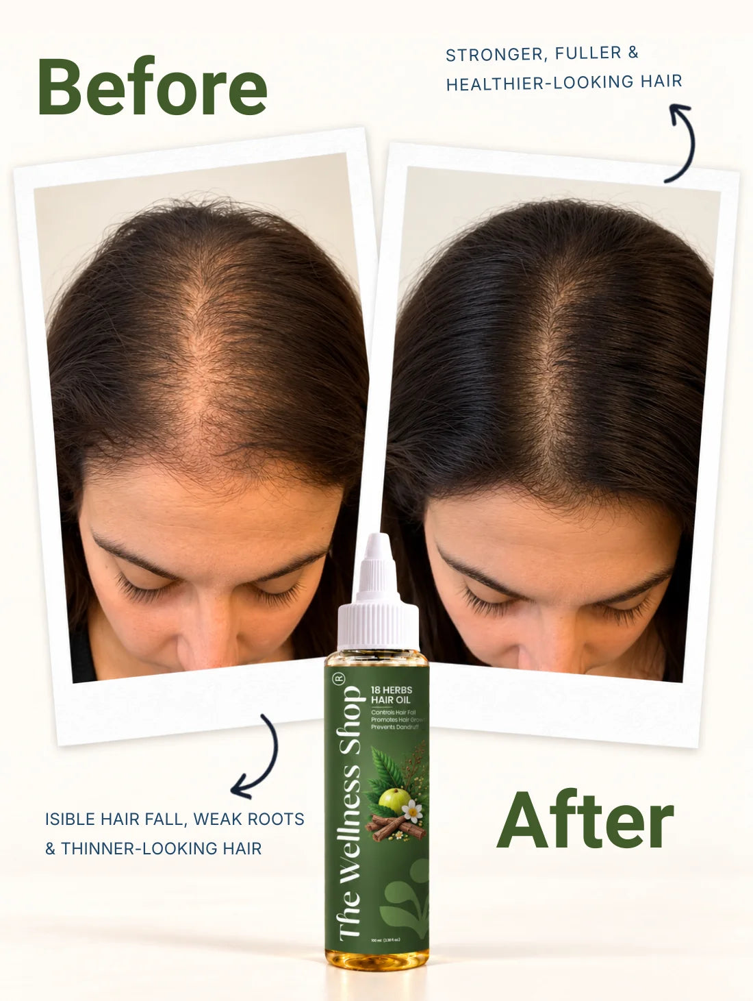 18 Herbs Hair Growth Oil