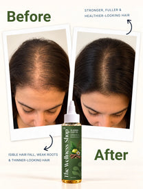 18 Herbs Hair Growth Oil