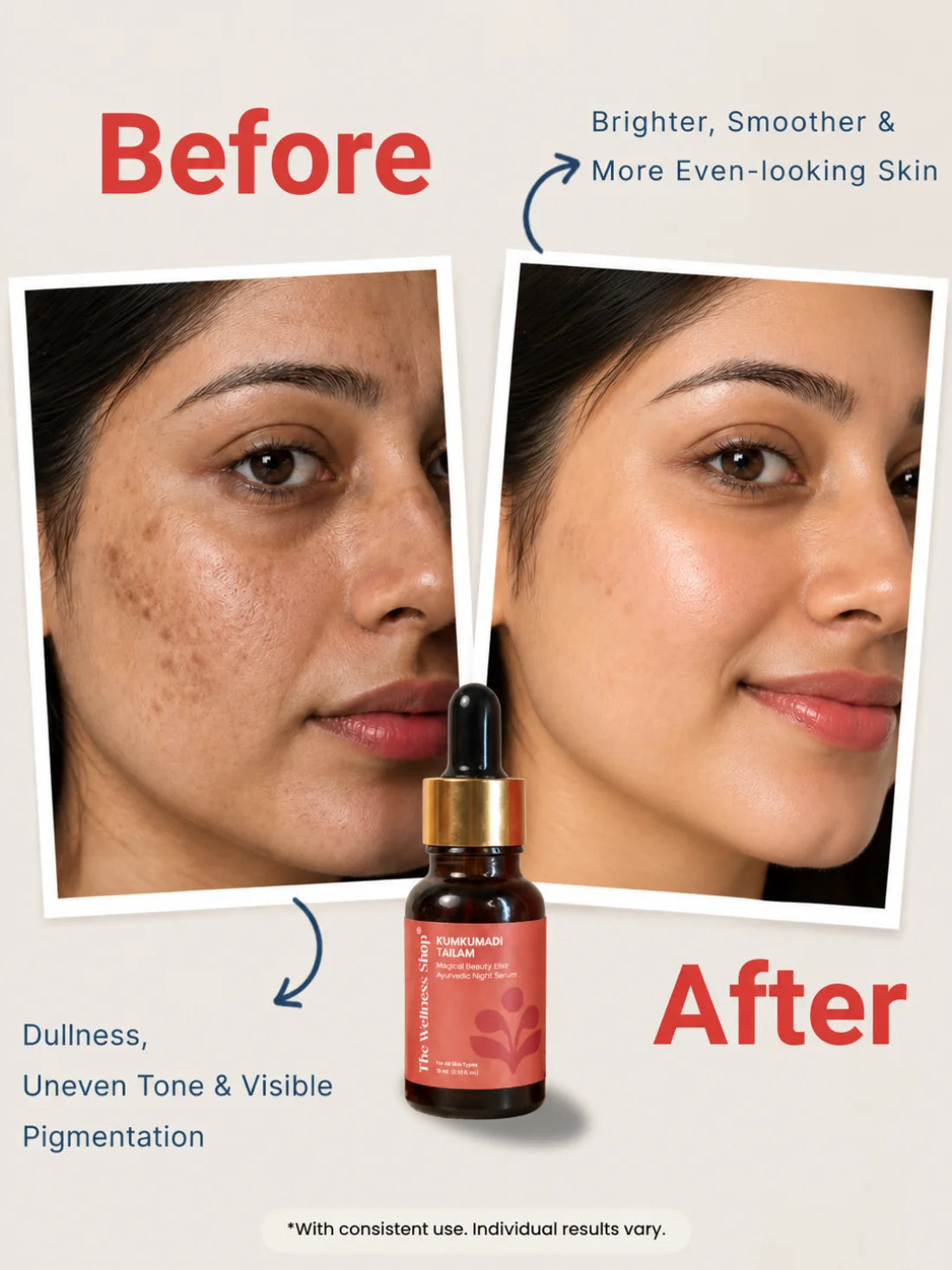 Kumkumadi Tailam Magical Beauty Elixir Ayurvedic Night Serum
