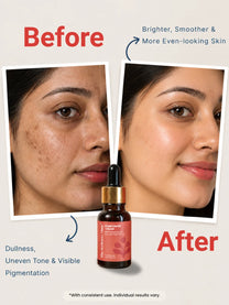 Kumkumadi Tailam Magical Beauty Elixir Ayurvedic Night Serum