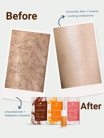 Turmeric Facial Wax+ Bikini Wax Powder+ Chocolate Hair Removal Powder + 4% Aha Bha Underarm Roll On