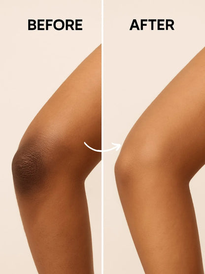 UNDER ARMS, KNEE AND ELBOW LIGHTENING CREAM