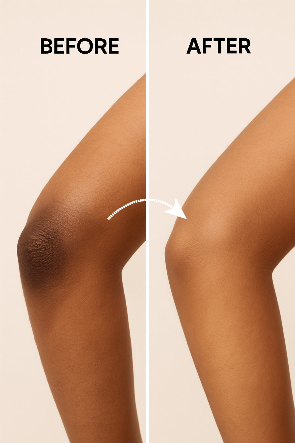 Under Arms, Knee And Elbow Lightening Cream