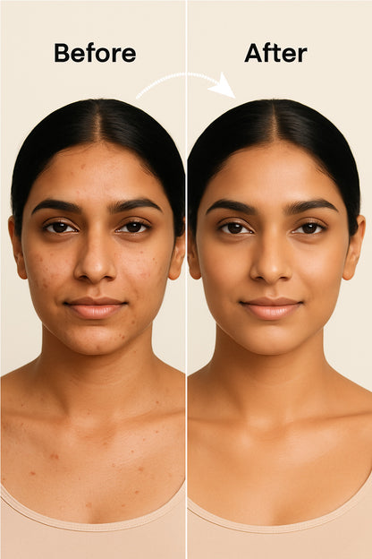 0.3% RETINOL - FACE SERUM FOR COLLAGEN PRODUCTION