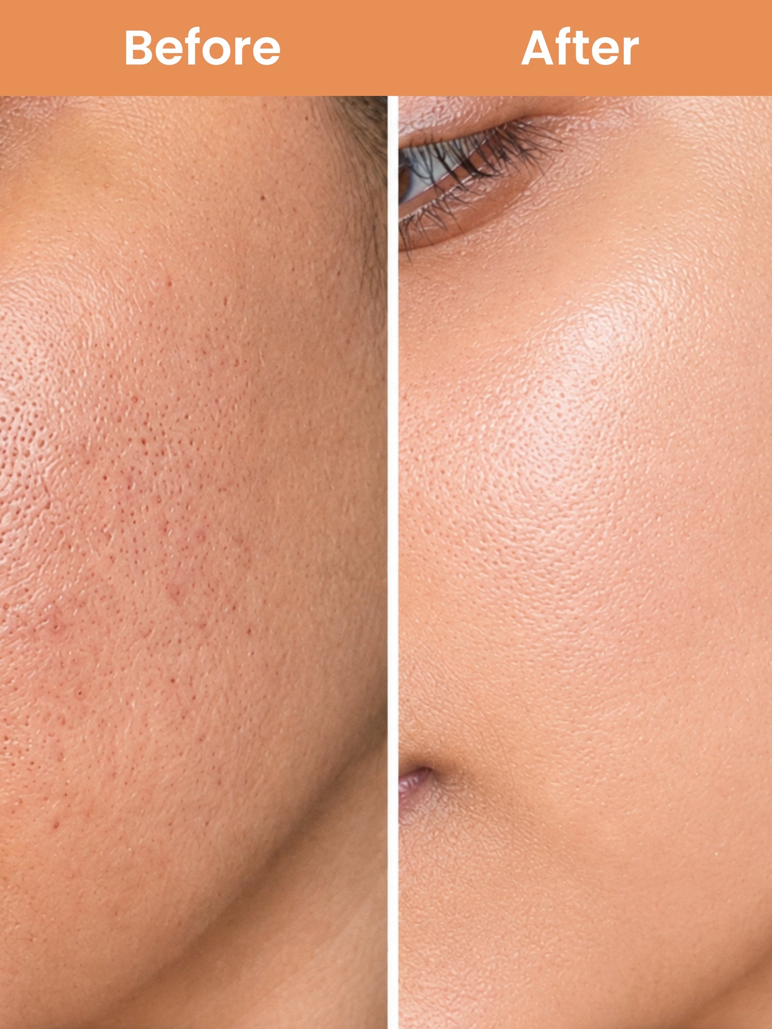 Open Pore Minimiser Face Serum