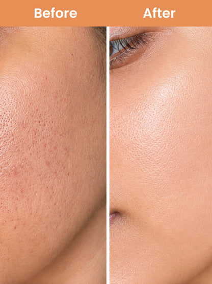 Open Pore Minimiser Face Serum