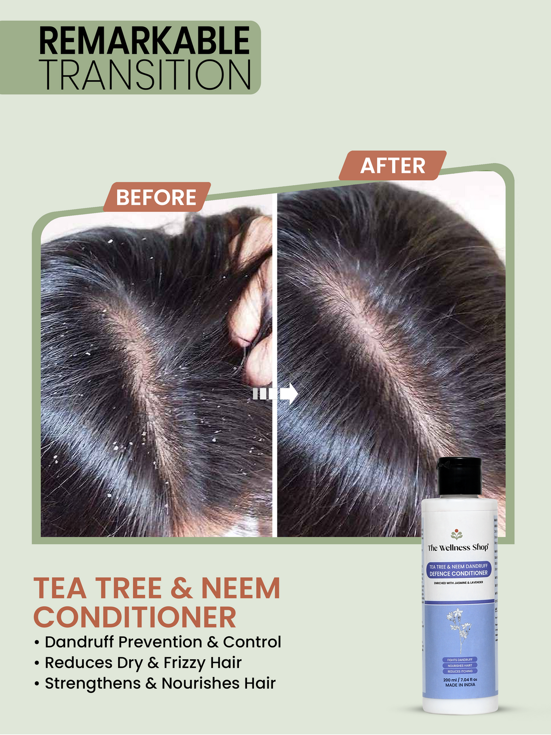 TEA TREE &amp; NEEM DANDRUFF DEFENSE CONDITIONER - DANDRUFF, DULLNESS &amp; LACK of SHINE