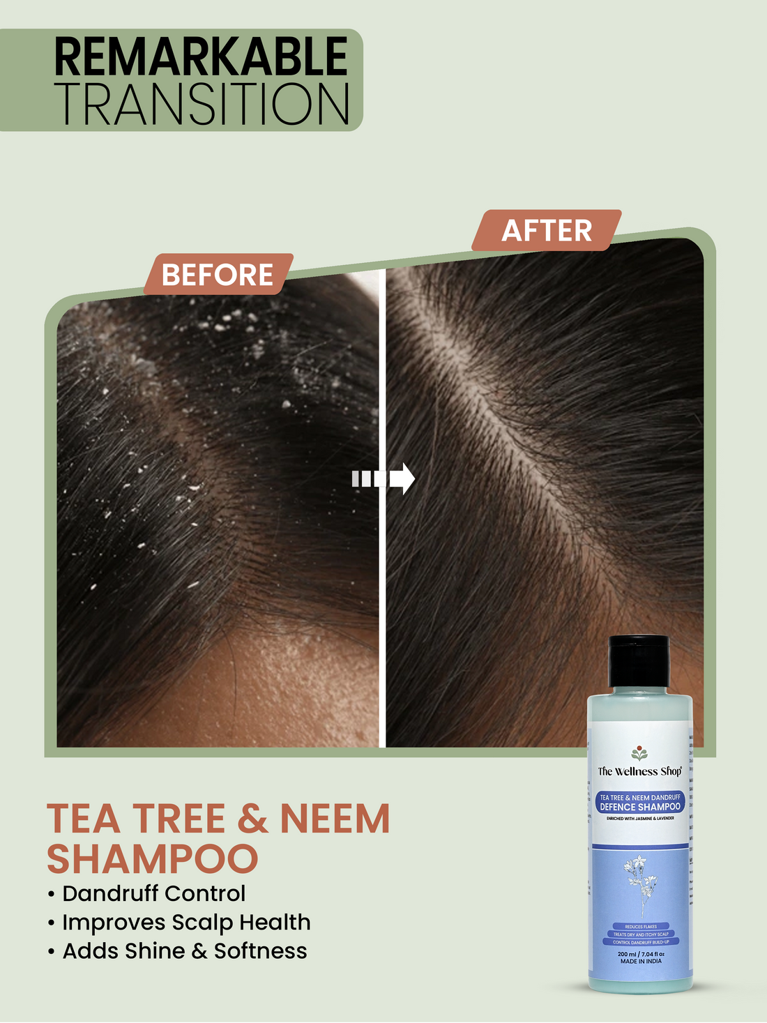 TEA TREE &amp; NEEM DANDRUFF DEFENSE SHAMPOO - DANDRUFF, SCALP ACNE