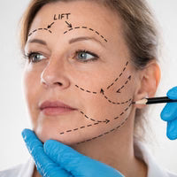 FILLER / BOTOX