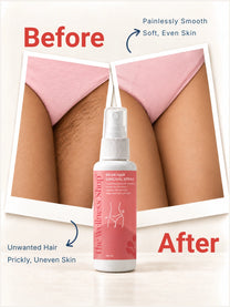 Bikini Hair Removal Spray – 10 Minute Painless Formula