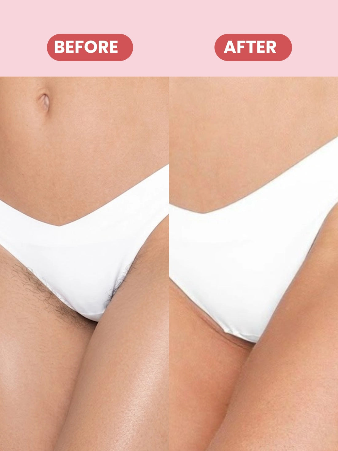 Bikini Hair Removal Spray