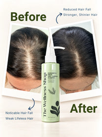 Rosemary & Methi Anti Hairfall Shampoo - Hair Fall & Thinning, Slow Hair Growth, Dullness & Lack Of Shine