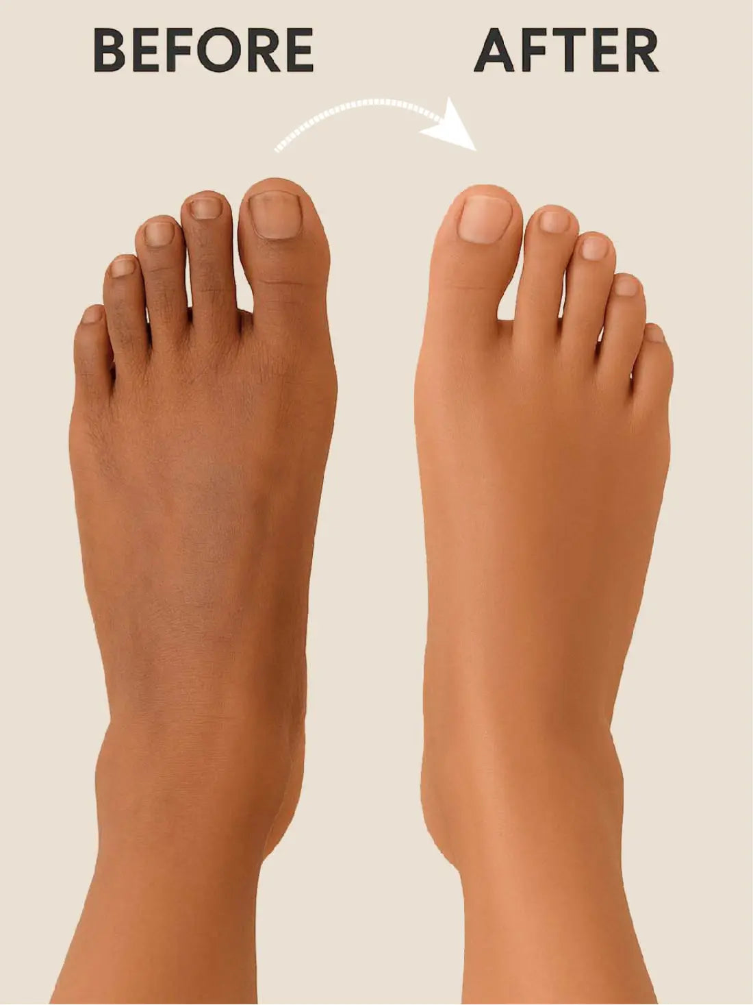 30 SEC FOOT PEELING SPRAY